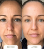 NatuGlow™ – The Ultimate Solution for Instantly Smoother, Brighter Skin