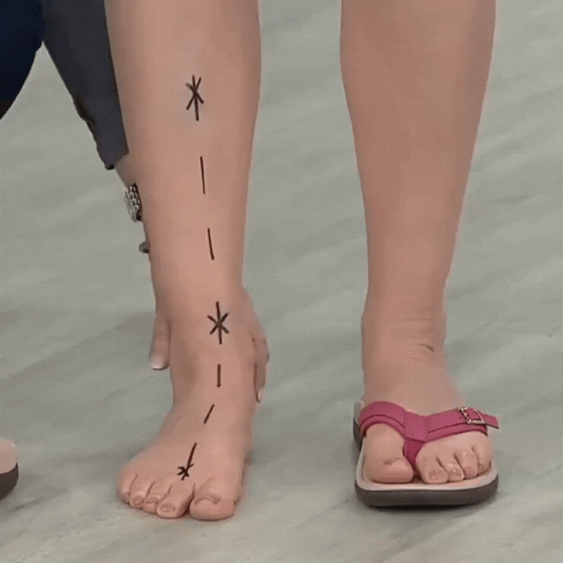 Pylera™ | Orthopaedic Summer Sandals