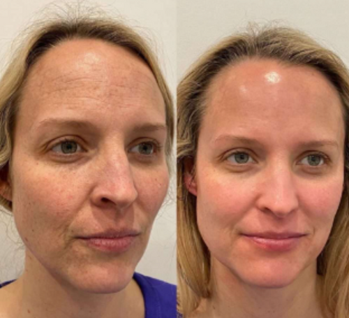 NatuGlow™ – The Ultimate Solution for Instantly Smoother, Brighter Skin