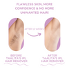 Glow Soft™ Painless Hair Removal