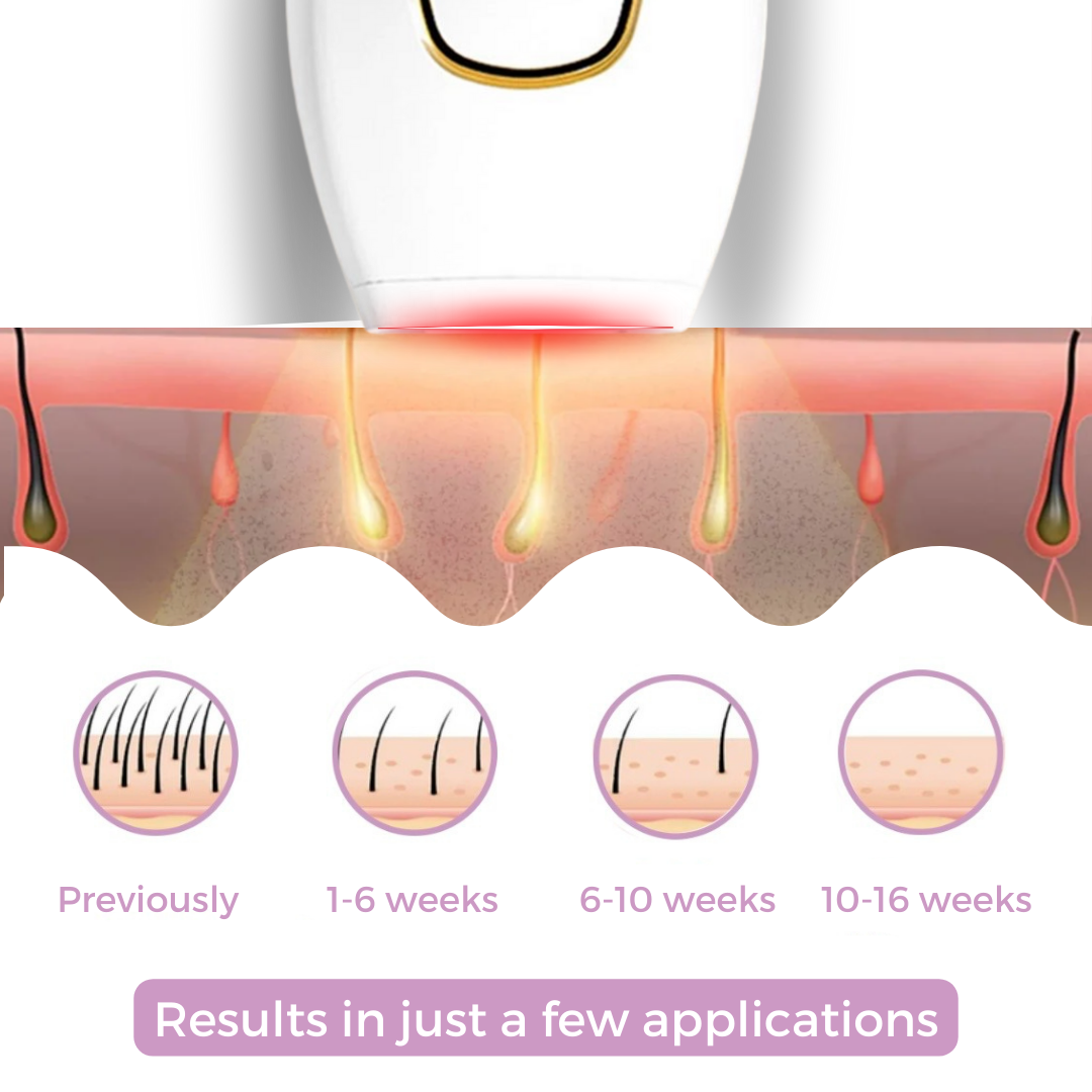 Glow Soft™ Painless Hair Removal