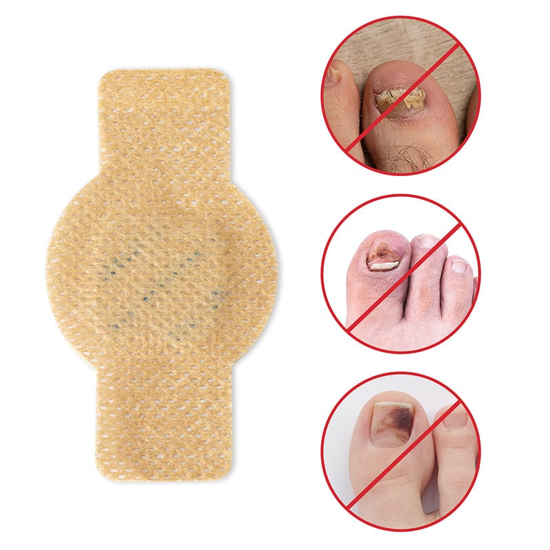 1+1 FREE | Nailox™ – Fast & Discreet Nail Fungus Treatment