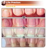 NailVita - 7 Days Nail Growth & Strengthening Serum