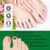 Nail treatment – Natural antifungal care