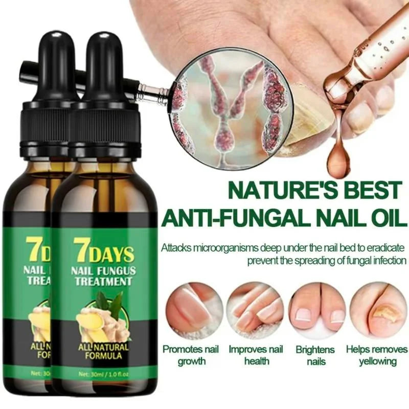 Nail treatment – Natural antifungal care