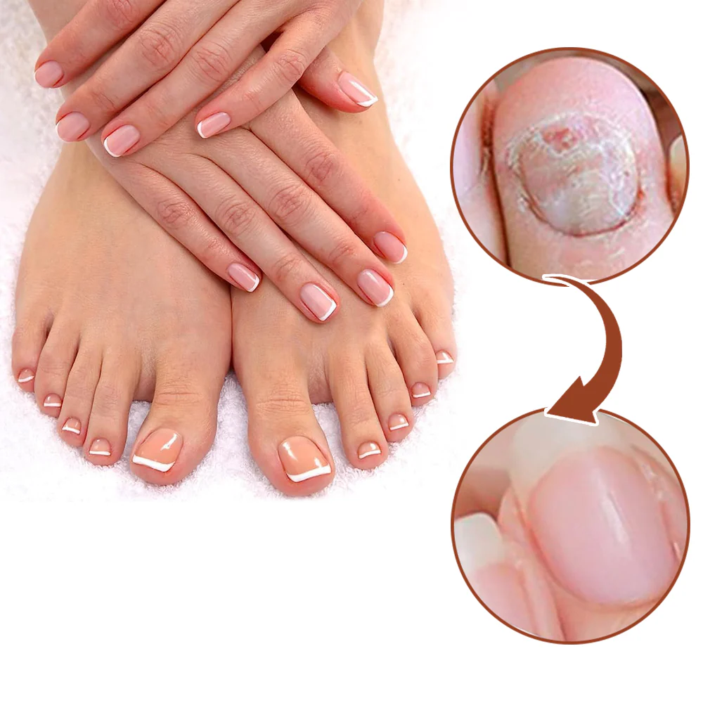 NailVita - 7 Days Nail Growth & Strengthening Serum