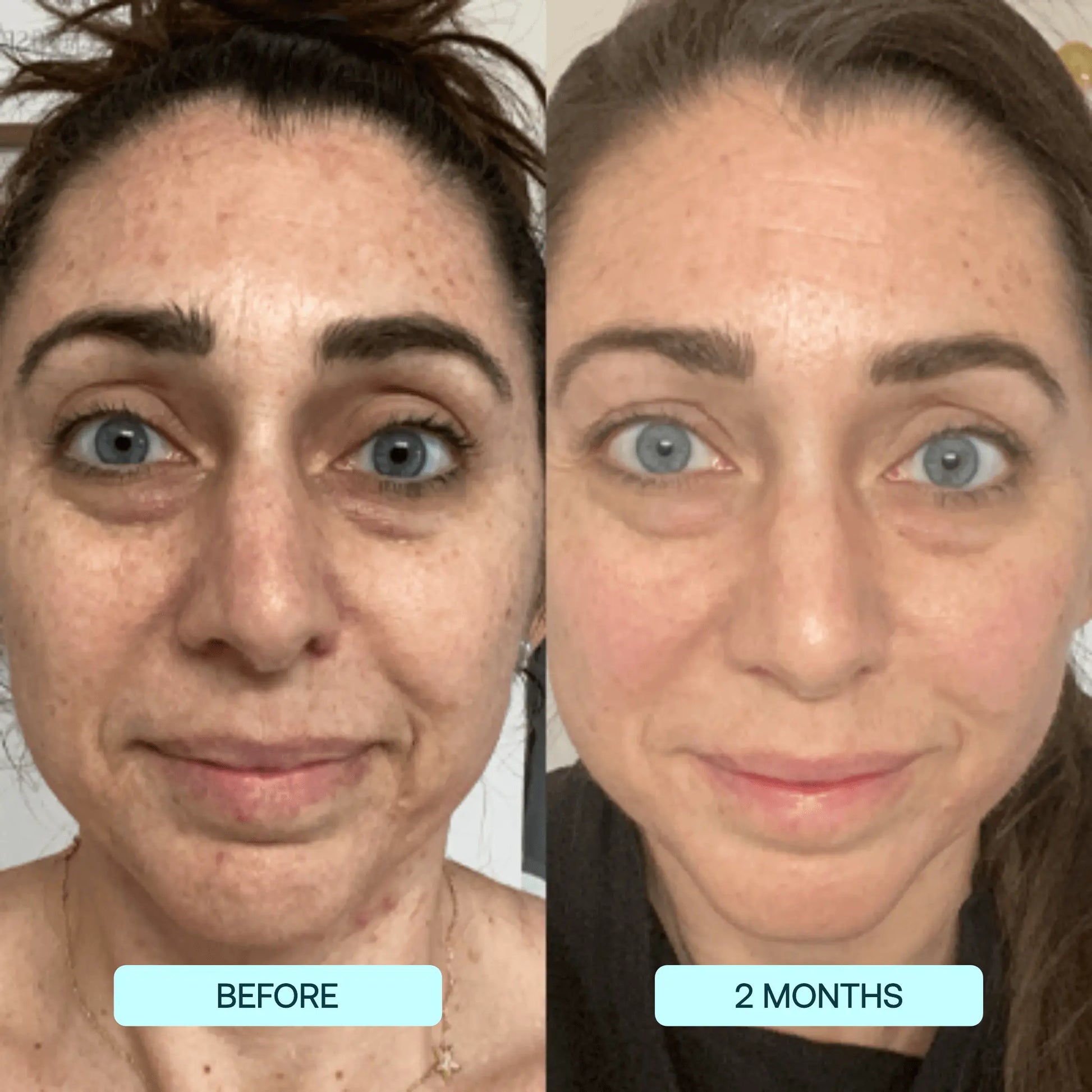 NatuGlow™ – The Ultimate Solution for Instantly Smoother, Brighter Skin