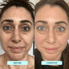 NatuGlow™ – The Ultimate Solution for Instantly Smoother, Brighter Skin
