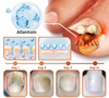 NailVita - 7 Days Nail Growth & Strengthening Serum